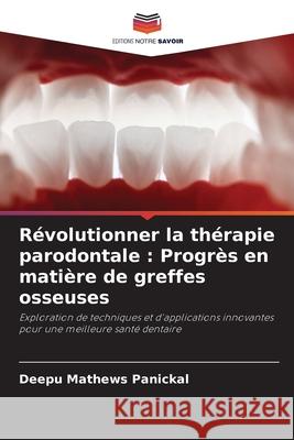 R?volutionner la th?rapie parodontale: Progr?s en mati?re de greffes osseuses Deepu Mathew 9786207560929 Editions Notre Savoir