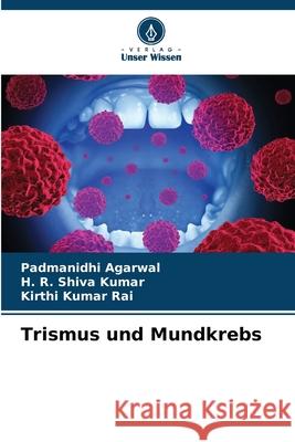 Trismus und Mundkrebs Padmanidhi Agarwal H. R. Shiv Kirthi Kumar Rai 9786207572519