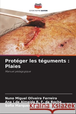Prot?ger les t?guments: Plaies Nuno Miguel Oliveira Ferreira Ana I. de Almeida R. F. Da Rocha Sofia Marques Grilo Ferreira 9786207579235