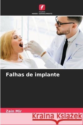 Falhas de implante Zain Mir 9786207582730