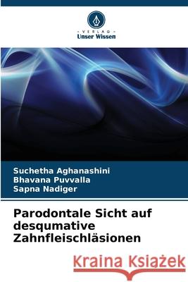 Parodontale Sicht auf desqumative Zahnfleischl?sionen Suchetha Aghanashini Bhavana Puvvalla Sapna Nadiger 9786207586219