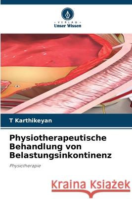 Physiotherapeutische Behandlung von Belastungsinkontinenz T. Karthikeyan 9786207604685 Verlag Unser Wissen