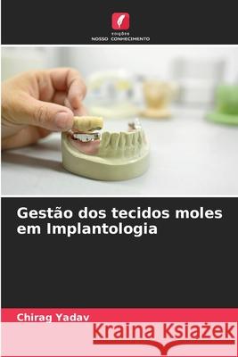 Gest?o dos tecidos moles em Implantologia Chirag Yadav 9786207615230