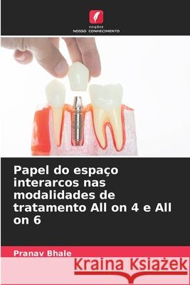 Papel do espa?o interarcos nas modalidades de tratamento All on 4 e All on 6 Pranav Bhale 9786207629121