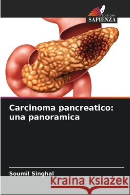 Carcinoma pancreatico: una panoramica Soumil Singhal 9786207630479