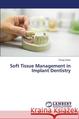Soft Tissue Management in Implant Dentistry Chirag Yadav 9786207639588
