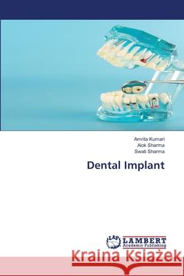 Dental Implant Amrita Kumari Alok Sharma Swati Sharma 9786207640164 LAP Lambert Academic Publishing