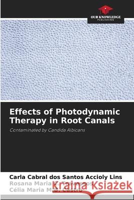 Effects of Photodynamic Therapy in Root Canals Accioly Lins, Carla Cabral dos Santos, Travassos, Rosana Maria C., Castro, Célia Maria M.B. 9786207643981