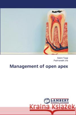 Management of open apex Saloni Tyagi Padmanabh Jha 9786207647743