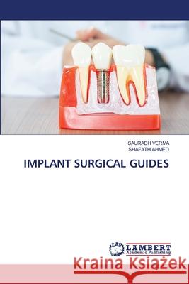 Implant Surgical Guides Saurabh Verma Shafath Ahmed 9786207648351