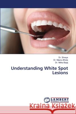 Understanding White Spot Lesions Shreya, Dr., Bhola, Dr. Meenu, Bajaj, Dr. Nitika 9786207651993