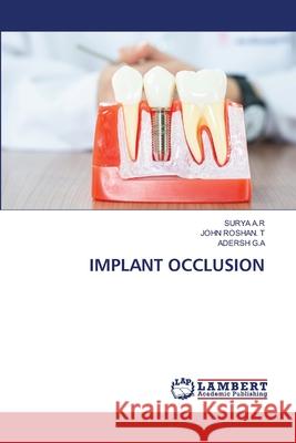 Implant Occlusion Surya A John Rosha Adersh G 9786207652693