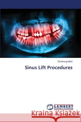 Sinus Lift Procedures Shubhangi Behl 9786207654437 LAP Lambert Academic Publishing