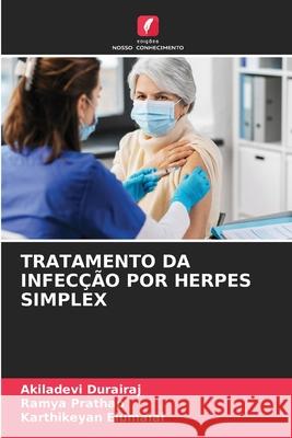 Tratamento Da Infec??o Por Herpes Simplex Akiladevi Durairaj Ramya Prathap Karthikeyan Elumalai 9786207661398