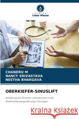 Oberkiefer-Sinuslift Chandru M Nancy Srivastava Neetha Bhargava 9786207663583