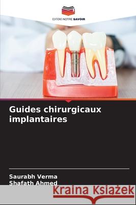 Guides chirurgicaux implantaires Saurabh Verma Shafath Ahmed 9786207663675 Editions Notre Savoir