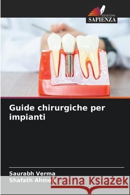 Guide chirurgiche per impianti Saurabh Verma Shafath Ahmed 9786207663682 Edizioni Sapienza