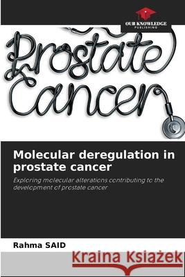 Molecular deregulation in prostate cancer Rahma Said 9786207664436 Our Knowledge Publishing