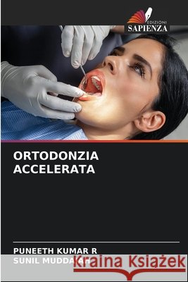 Ortodonzia Accelerata Puneeth Kuma Sunil Muddaiah 9786207664573