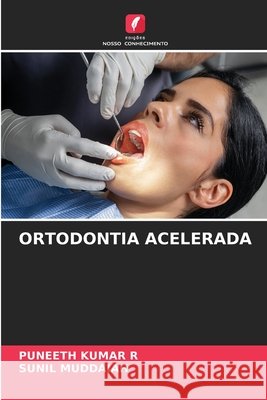Ortodontia Acelerada Puneeth Kuma Sunil Muddaiah 9786207664580