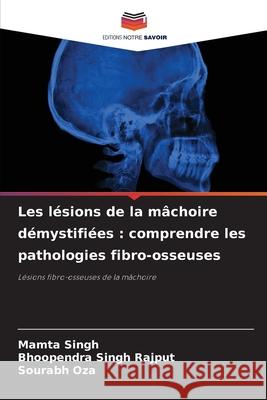 Les l?sions de la m?choire d?mystifi?es: comprendre les pathologies fibro-osseuses Mamta Singh Bhoopendra Singh Rajput Sourabh Oza 9786207671236 Editions Notre Savoir