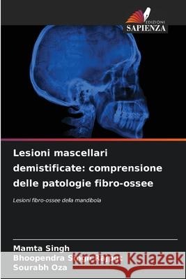 Lesioni mascellari demistificate: comprensione delle patologie fibro-ossee Mamta Singh Bhoopendra Singh Rajput Sourabh Oza 9786207671243 Edizioni Sapienza