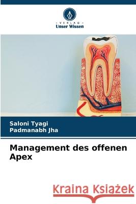 Management des offenen Apex Saloni Tyagi Padmanabh Jha 9786207673315 Verlag Unser Wissen