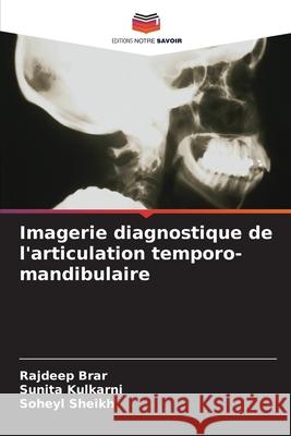 Imagerie diagnostique de l'articulation temporo-mandibulaire Rajdeep Brar Sunita Kulkarni Soheyl Sheikh 9786207674237