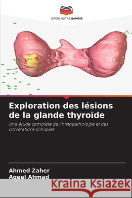 Exploration des l?sions de la glande thyro?de Ahmed Zaher Aqeel Ahmad 9786207681334