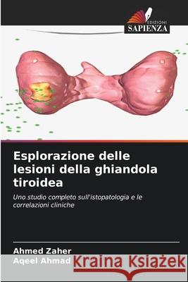 Esplorazione delle lesioni della ghiandola tiroidea Ahmed Zaher Aqeel Ahmad 9786207681358