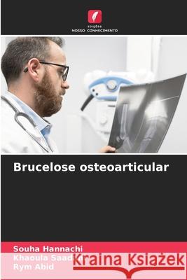 Brucelose osteoarticular Souha Hannachi Khaoula Saadani Rym Abid 9786207682898 Edicoes Nosso Conhecimento