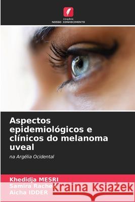 Aspectos epidemiol?gicos e cl?nicos do melanoma uveal Khedidja Mesri Samira Rached Aicha Idder 9786207686643