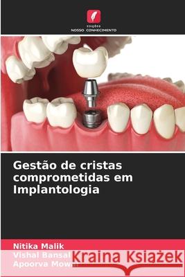 Gest?o de cristas comprometidas em Implantologia Nitika Malik Vishal Bansal Apoorva Mowar 9786207690916 Edicoes Nosso Conhecimento