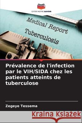 Pr?valence de l'infection par le VIH/SIDA chez les patients atteints de tuberculose Zegeye Tessema 9786207694020 Editions Notre Savoir