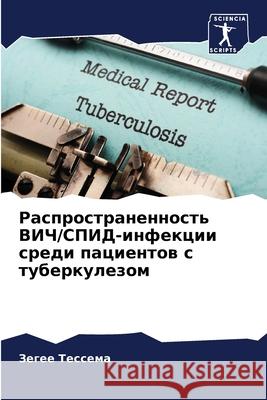 Распространенность ВИЧ/& Тессеl 9786207694051 Sciencia Scripts