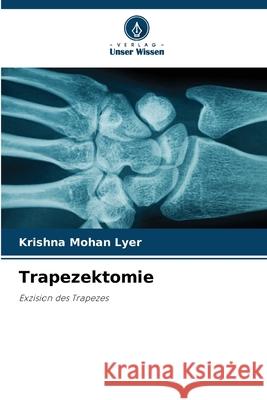 Trapezektomie Krishna Mohan Lyer 9786207698028 Verlag Unser Wissen