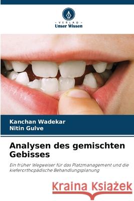 Analysen des gemischten Gebisses Kanchan Wadekar Nitin Gulve 9786207710096