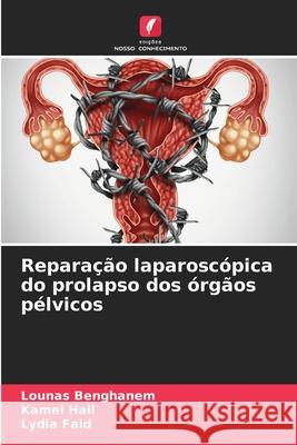 Repara??o laparosc?pica do prolapso dos ?rg?os p?lvicos Lounas Benghanem Kamel Hail Lydia Faid 9786207711512 Edicoes Nosso Conhecimento