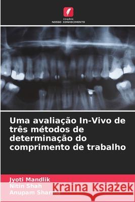 Uma avalia??o In-Vivo de tr?s m?todos de determina??o do comprimento de trabalho Jyoti Mandlik Nitin Shah Anupam Sharma 9786207731640 Edicoes Nosso Conhecimento