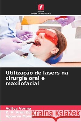 Utiliza??o de lasers na cirurgia oral e maxilofacial Aditya Verma K. V. Aru Apoorva Mowar 9786207745043 Edicoes Nosso Conhecimento