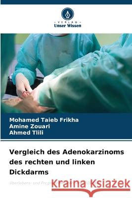 Vergleich des Adenokarzinoms des rechten und linken Dickdarms Mohamed Taieb Frikha Amine Zouari Ahmed Tlili 9786207750061 Verlag Unser Wissen