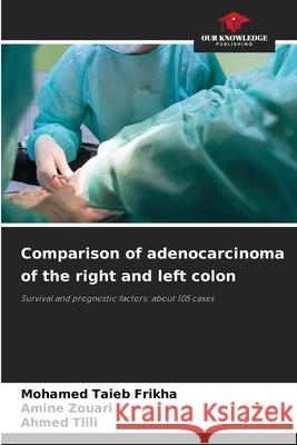 Comparison of adenocarcinoma of the right and left colon Mohamed Taieb Frikha Amine Zouari Ahmed Tlili 9786207750245 Our Knowledge Publishing