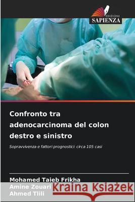 Confronto tra adenocarcinoma del colon destro e sinistro Mohamed Taieb Frikha Amine Zouari Ahmed Tlili 9786207750283 Edizioni Sapienza