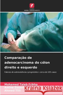 Compara??o de adenocarcinoma do c?lon direito e esquerdo Mohamed Taieb Frikha Amine Zouari Ahmed Tlili 9786207750313 Edicoes Nosso Conhecimento