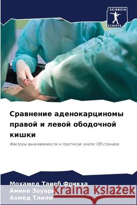 Сравнение аденокарцино&# Фрикхk Зоуарl  Тлили 9786207750320 Sciencia Scripts