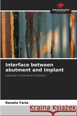 Interface between abutment and implant Renata Faria 9786207762781