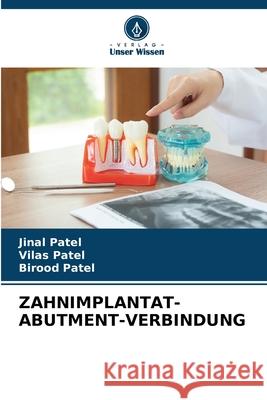 Zahnimplantat-Abutment-Verbindung Jinal Patel Vilas Patel Birood Patel 9786207763733 Verlag Unser Wissen