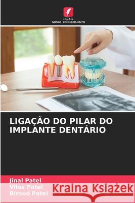 Liga??o Do Pilar Do Implante Dent?rio Jinal Patel Vilas Patel Birood Patel 9786207763771 Edicoes Nosso Conhecimento