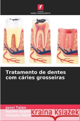 Tratamento de dentes com c?ries grosseiras Janvi Talan Sachin Gupta Vineeta Nikhil 9786207766826 Edicoes Nosso Conhecimento