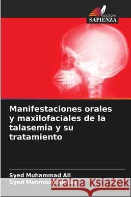 Manifestaciones orales y maxilofaciales de la talasemia y su tratamiento Syed Muhammad Ali Syed Mahmood Haider 9786207793150